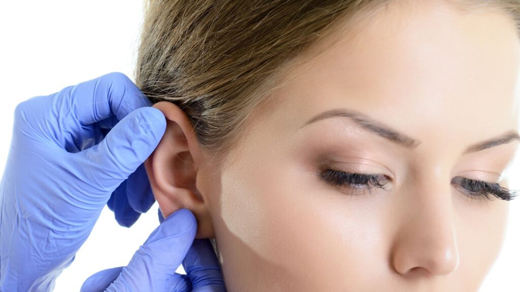Ear Cosmetic Surgery