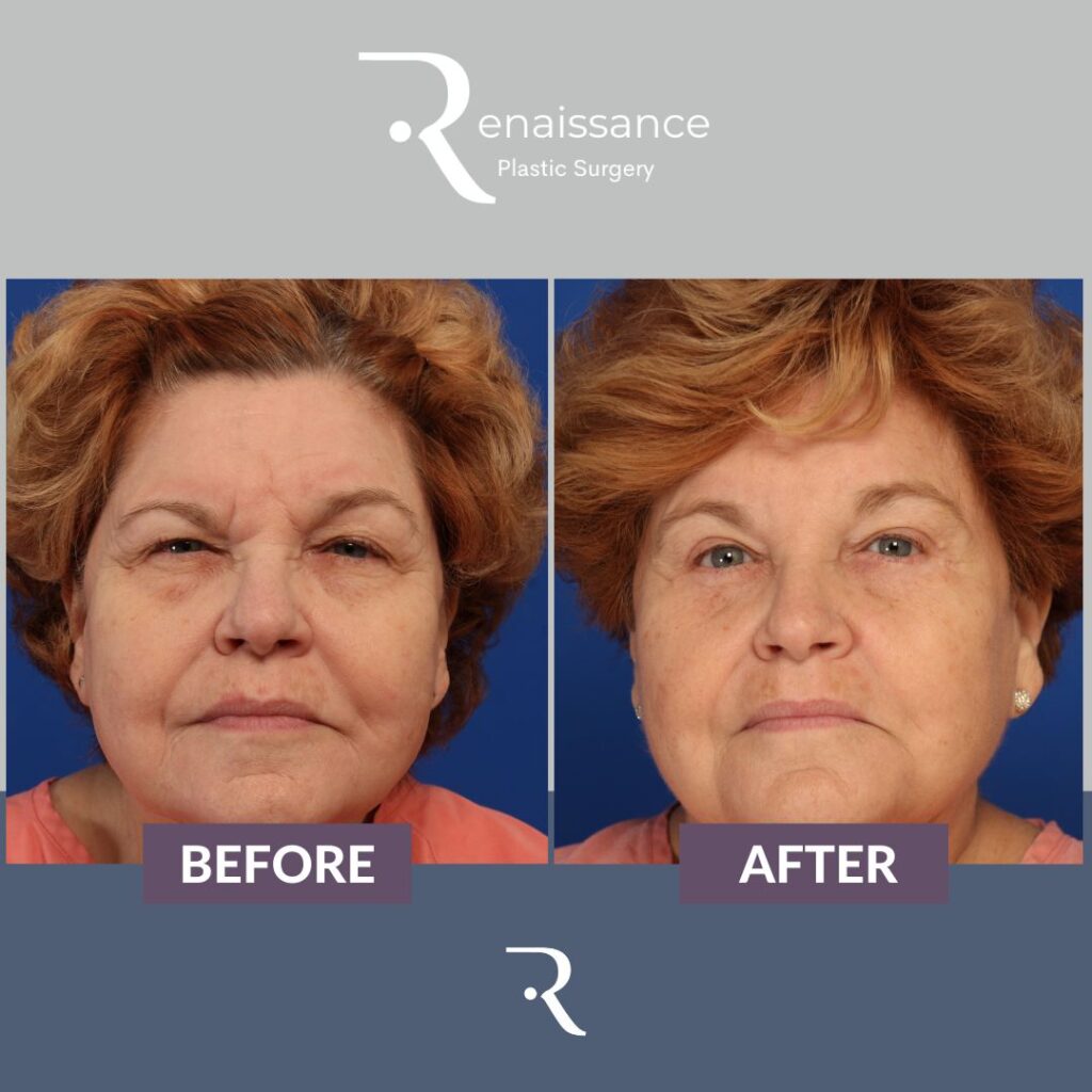 Renaissance Plastic Surgery Macon Ga