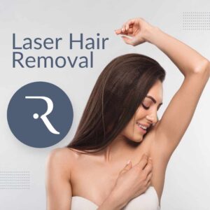 Laser Hair Removal