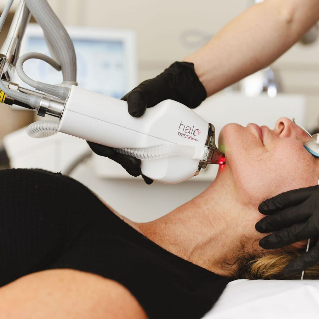 Halo Tribrid Laser Treatment