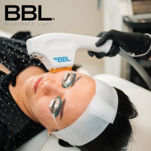 BBL Treatment