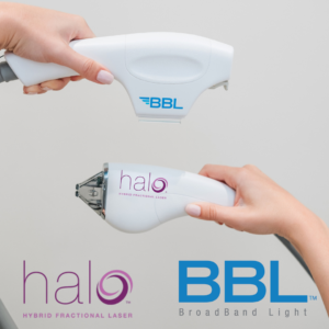 Halo and BBL