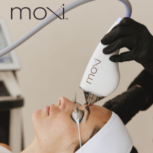 Moxi Treatment